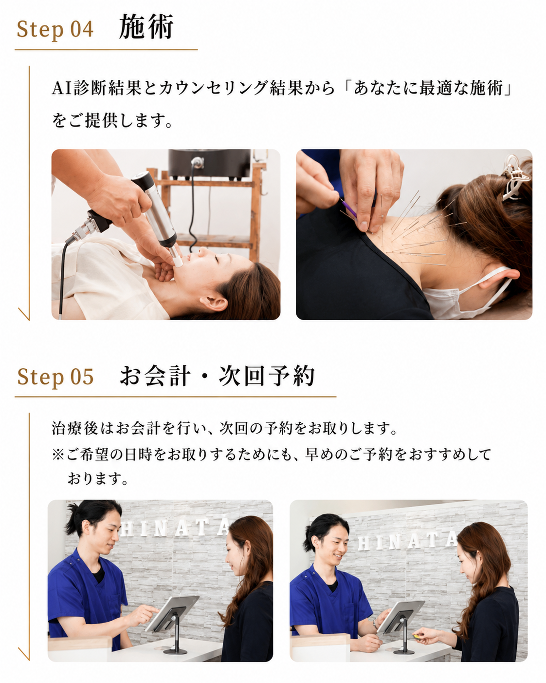 step04 施術　AI診断結果とカウンセリング結果から「あなたに最適な施術」をご提供します。